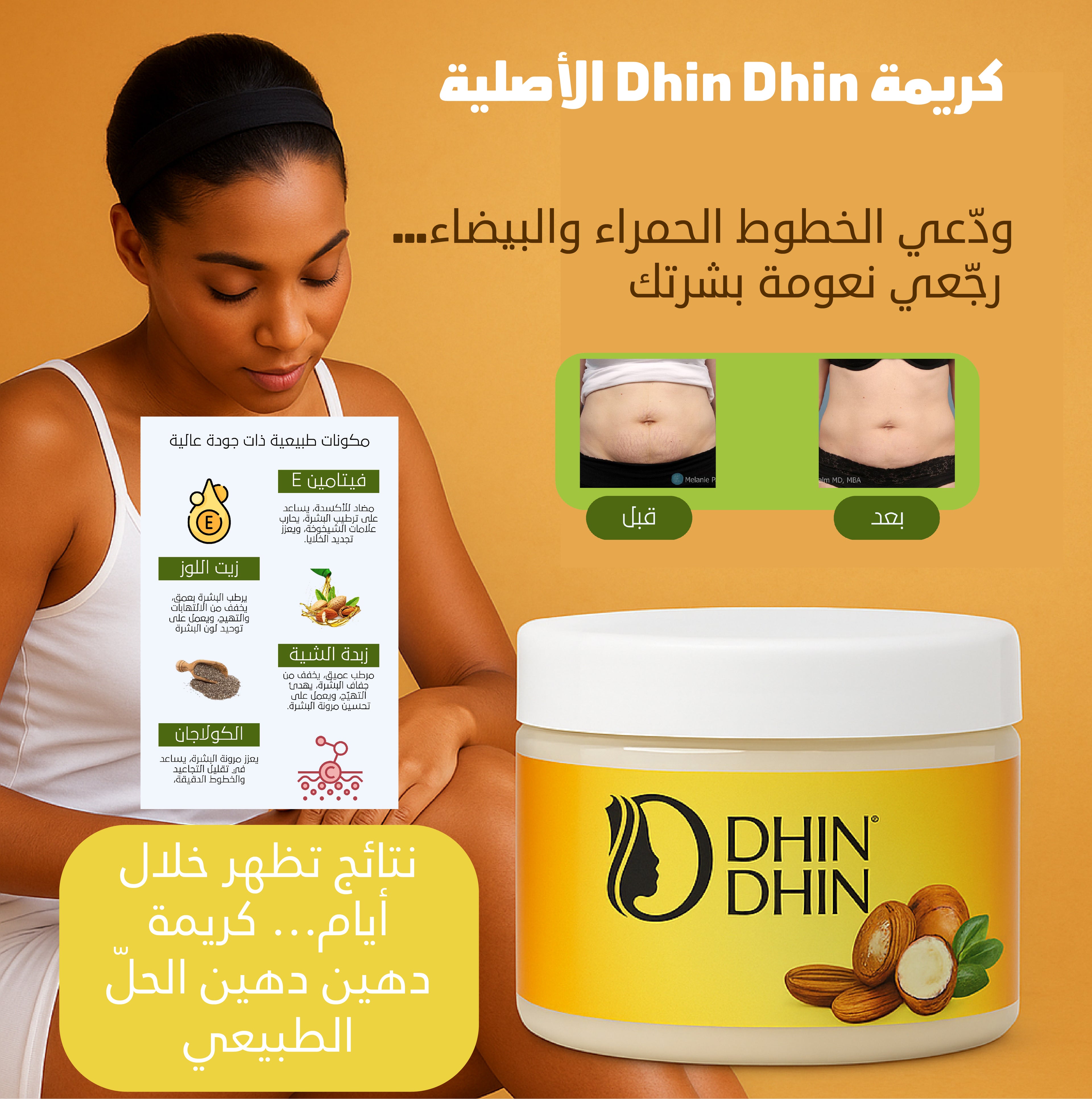 كريمة Dhin DHin – الحل الفعّال للخطوط البيضاء والحمراء وتجديد البشرة
